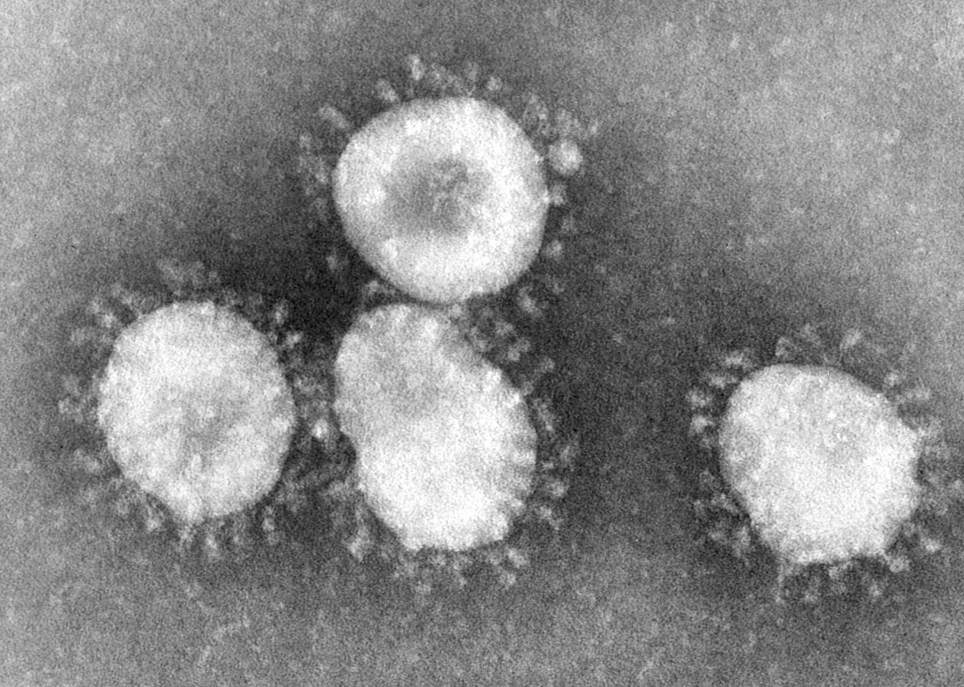 Imagen del coronavirus del SARS bajo el microscopio captada en abril de 2003. PHOTO EPA / CDC